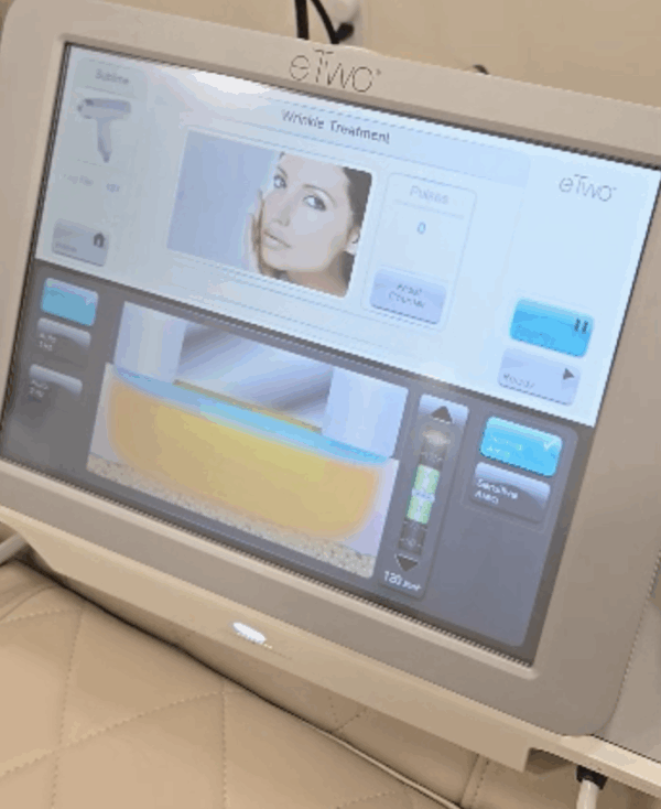 2019 Syneron eTwo w/ Sublative & Sublime HPs, Radio Frequency & Infared Light for Fractional, Sublative Skin Rejuvenation - FREE SHIPPING & WARRANTY (km/qui) - Image 6